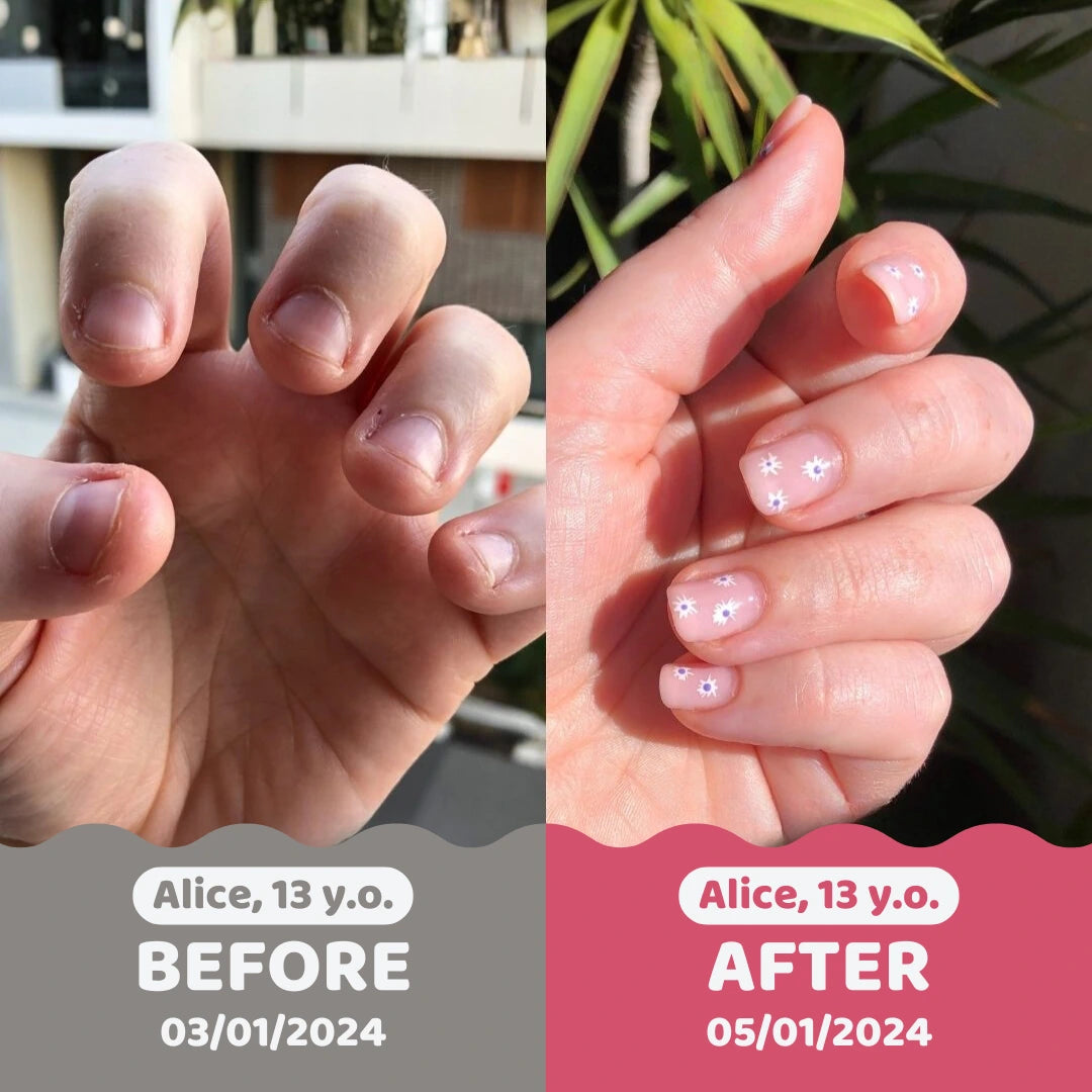 QuitBite | Stop Biting Nail polish