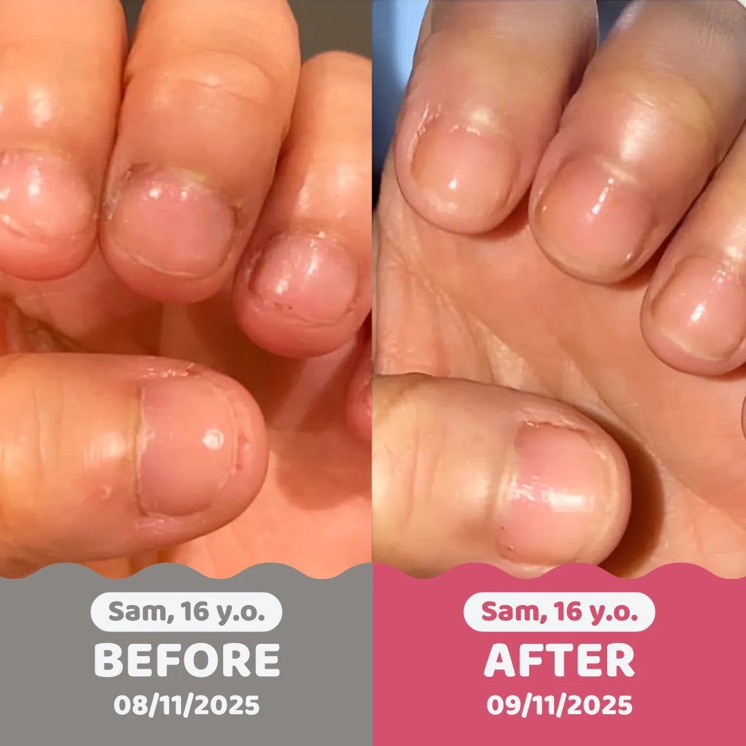 QuitBite | Stop Biting Nail polish